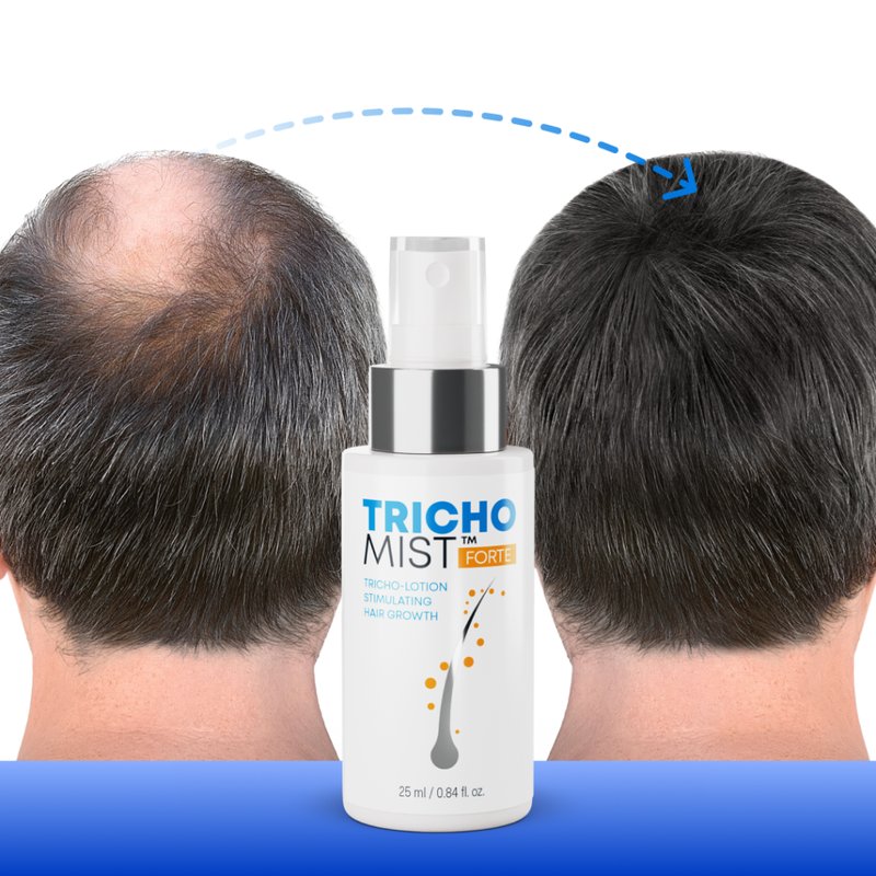 Trichomist forte cena apteka - Tricho Mist dla zdrowych włosów - Rozwiązanie dla problemów z włosami